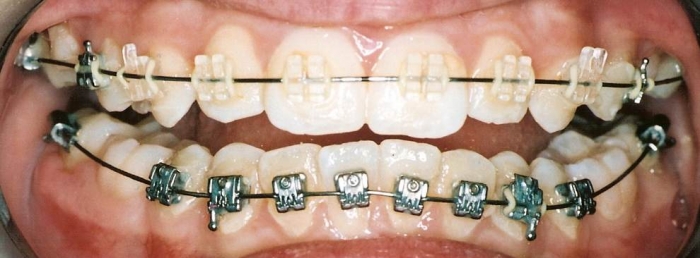 Orthodontics