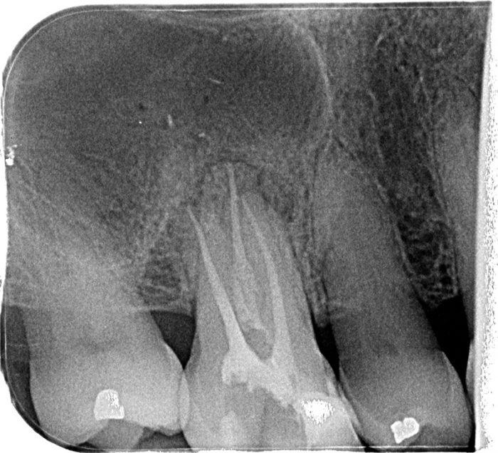 Endodontics