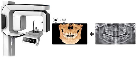 low radiation dose 2D and 3D Scanner